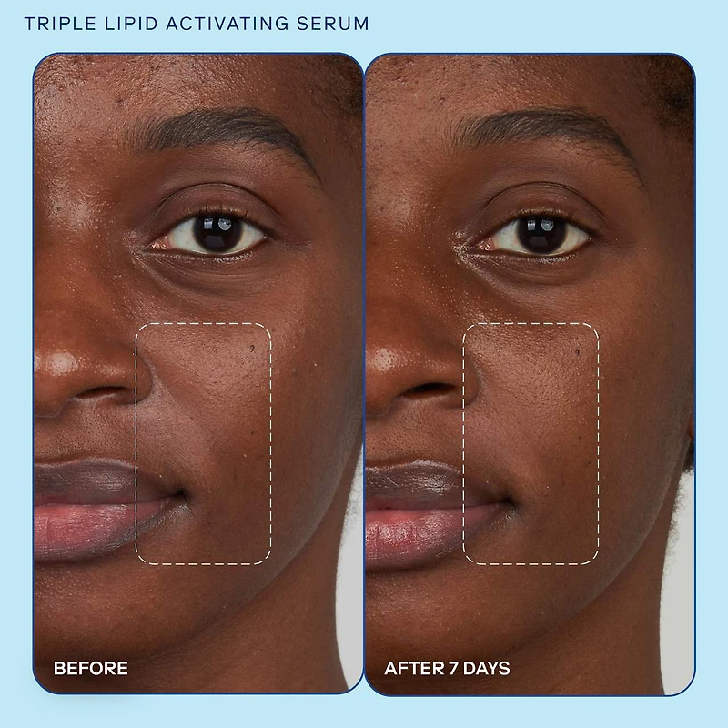 Sérum activateur de collagène Triple Lipid+
