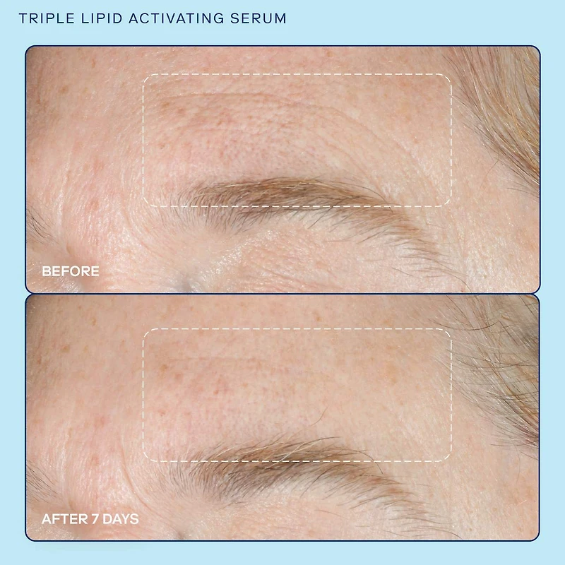 Sérum activateur de collagène Triple Lipid+