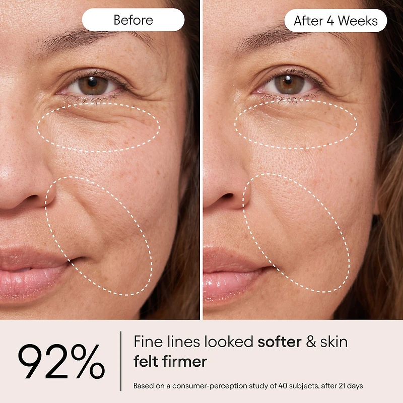 Super Peptide & Ghostberry Moisturizer for Eczema, Barrier and Wrinkle Repair