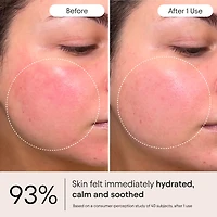 Super Peptide & Ghostberry Moisturizer for Eczema, Wrinkle and Barrier Repair