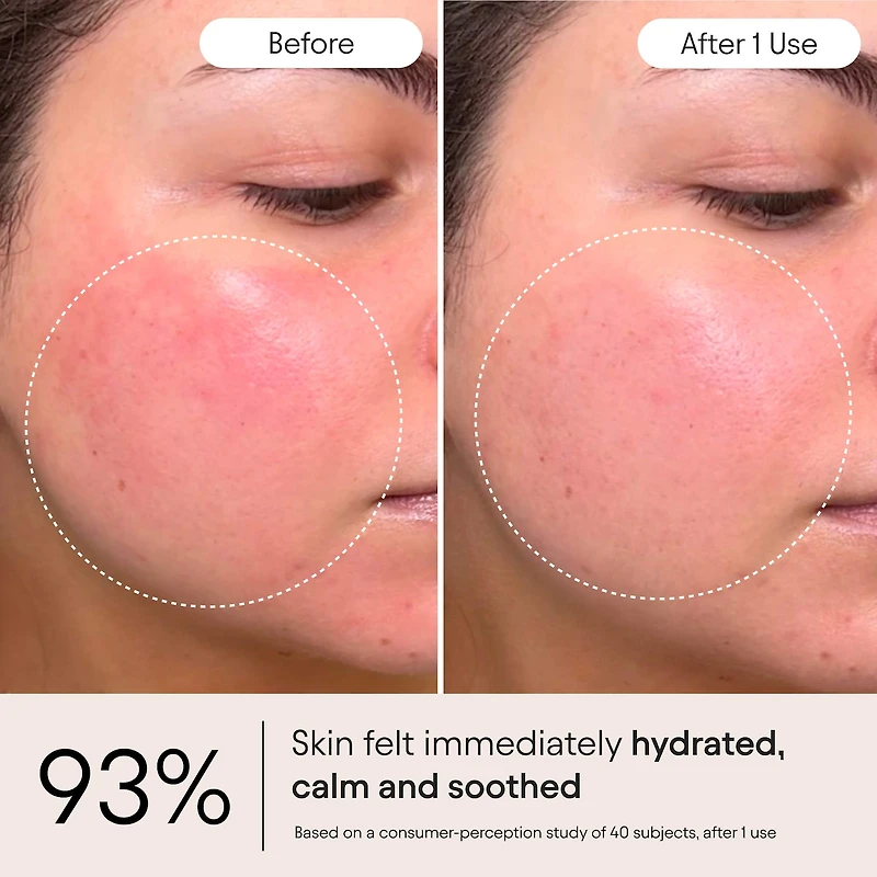 Super Peptide & Ghostberry Moisturizer for Eczema, Barrier and Wrinkle Repair