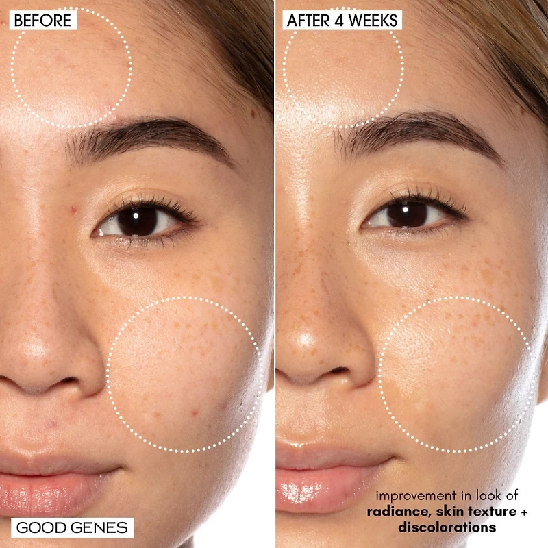 Good Genes All-In-One Lactic Acid Serum For Dark Spots And Uneven Texture
