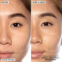 Good Genes All-In-One Lactic Acid Serum For Dark Spots And Uneven Texture