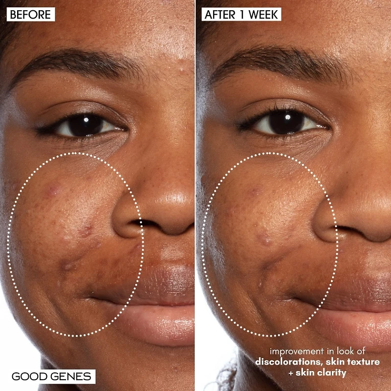 Good Genes All-In-One Lactic Acid Serum For Dark Spots And Uneven Texture