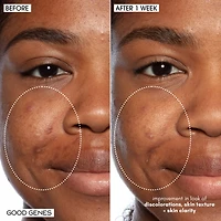 Good Genes All-In-One Lactic Acid Serum For Dark Spots And Uneven Texture