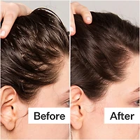 Salicylic Acid Scalp Renew Exfoliator For Oily + Flakey Scalp