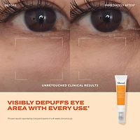 Gel contour des yeux anti-poches						