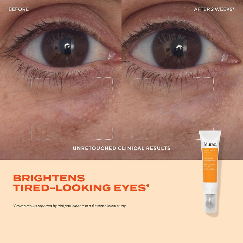 Gel contour des yeux anti-poches						