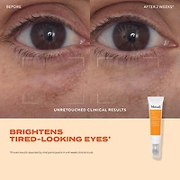 Gel contour des yeux anti-poches						