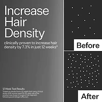 3% Stem Cell Peptide Hair + Scalp Treatment For Severe Hair Thinning