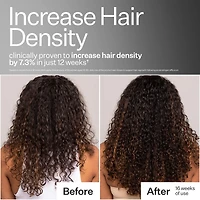 3% Stem Cell Peptide Hair + Scalp Treatment For Severe Hair Thinning