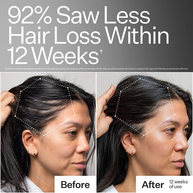 3% Stem Cell Peptide Hair + Scalp Treatment For Severe Hair Thinning