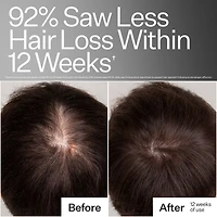 3% Stem Cell Peptide Hair + Scalp Treatment For Severe Hair Thinning