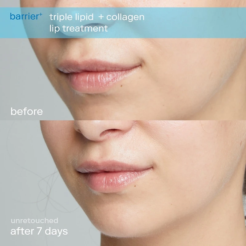 Soin pour les lèvres Triple Lipid Barrier+