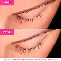 Trousse Lash Repair