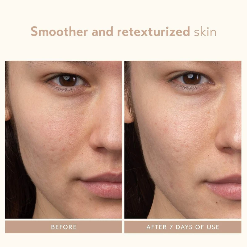 Sérum exfoliant à base d’acide lactique AHA