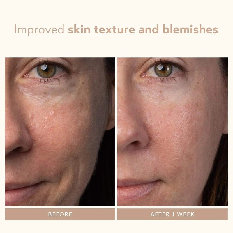 Sérum exfoliant à base d’acide lactique AHA
