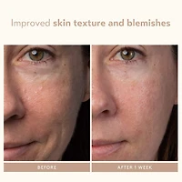 Sérum exfoliant à base d’acide lactique AHA