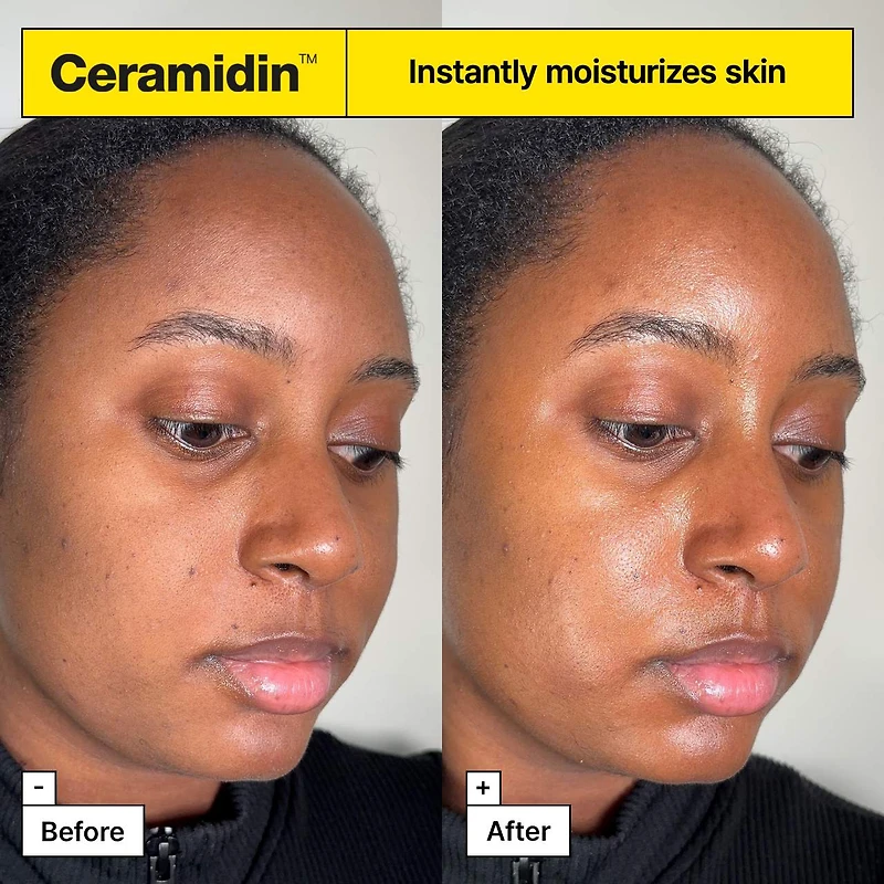 Crème hydratante Ceramididin™ pour la barrière cutanée