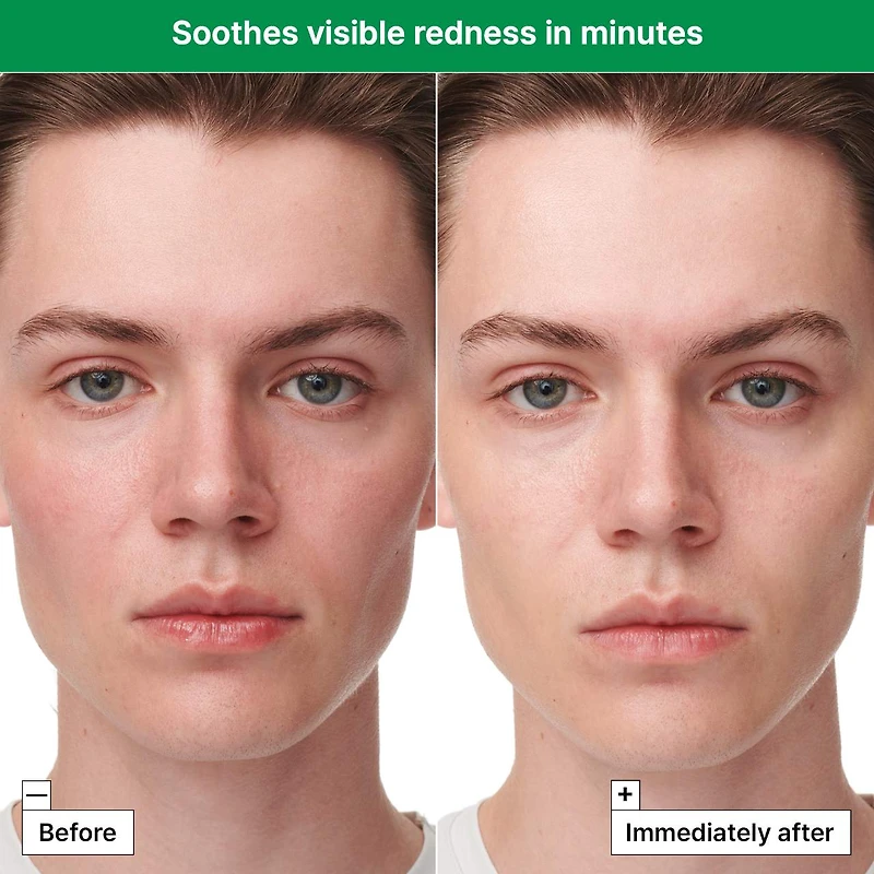 Masque visage sérum peau sensible Cicapair pour les rougeurs  						