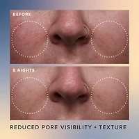 Honey Glow 17% AHA + BHA Resurfacing Acid Serum