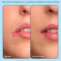 Eczema+ Pre-Biotic Foaming Oil Cleanser