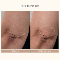 Body Reform Treatment Serum with 2% Granactive Retinoid