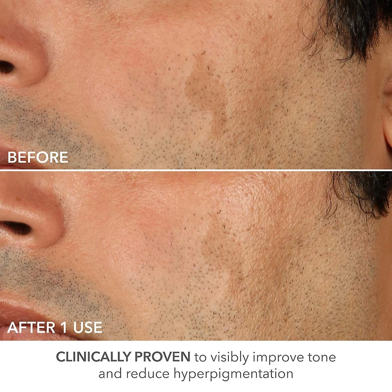 Advanced Retinol + Ferulic Perfectly Dosed Retinol Extra Strength 0.5%