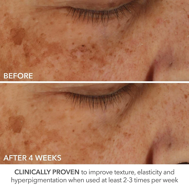 Soin Advanced Retinol + Ferulic à dose parfaite de Retinol extra fort à 0,2 %						