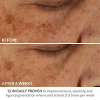 Soin Advanced Retinol + Ferulic à dose parfaite de Retinol extra fort à 0,2 %						