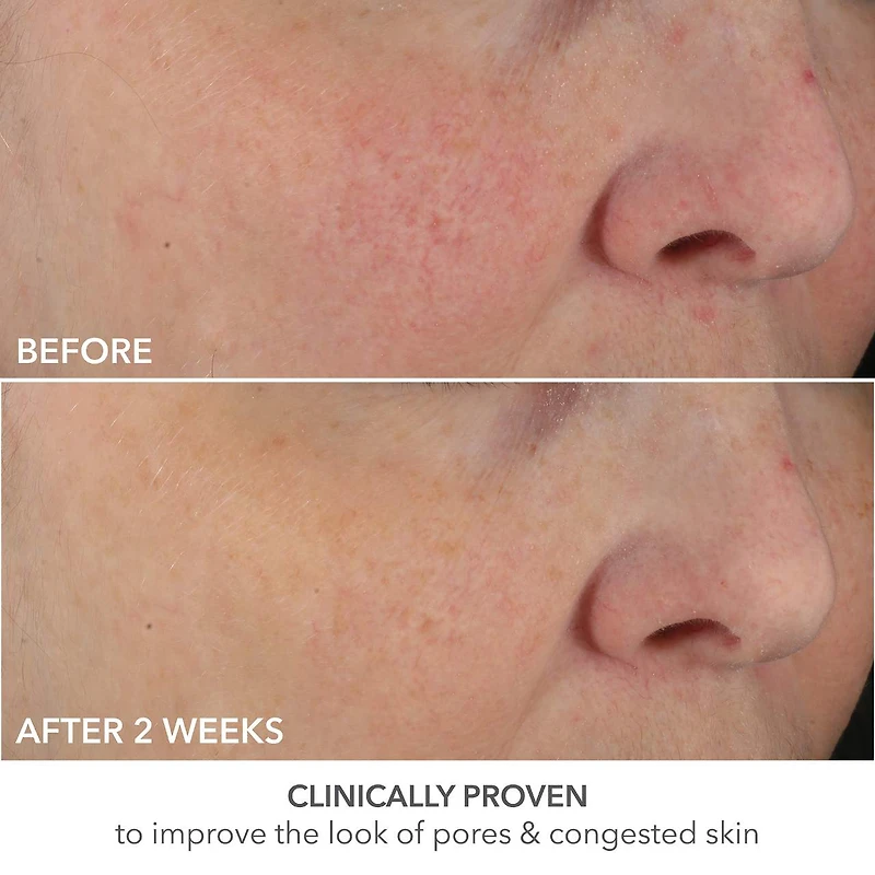 Soin Advanced Retinol + Ferulic à dose parfaite de Retinol extra fort à 0,2 %						