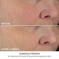Soin Advanced Retinol + Ferulic à dose parfaite de Retinol extra fort à 0,2 %						