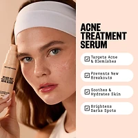 2% Salicylic Acid Daily Acne Treatment Serum