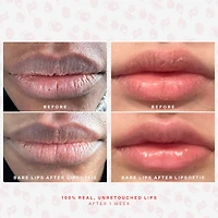 LipSoftie™ Hydrating Tinted Lip Treatment Balm