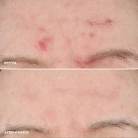 Vitamin Enriched Smoothing Serum with Niacinamide 
