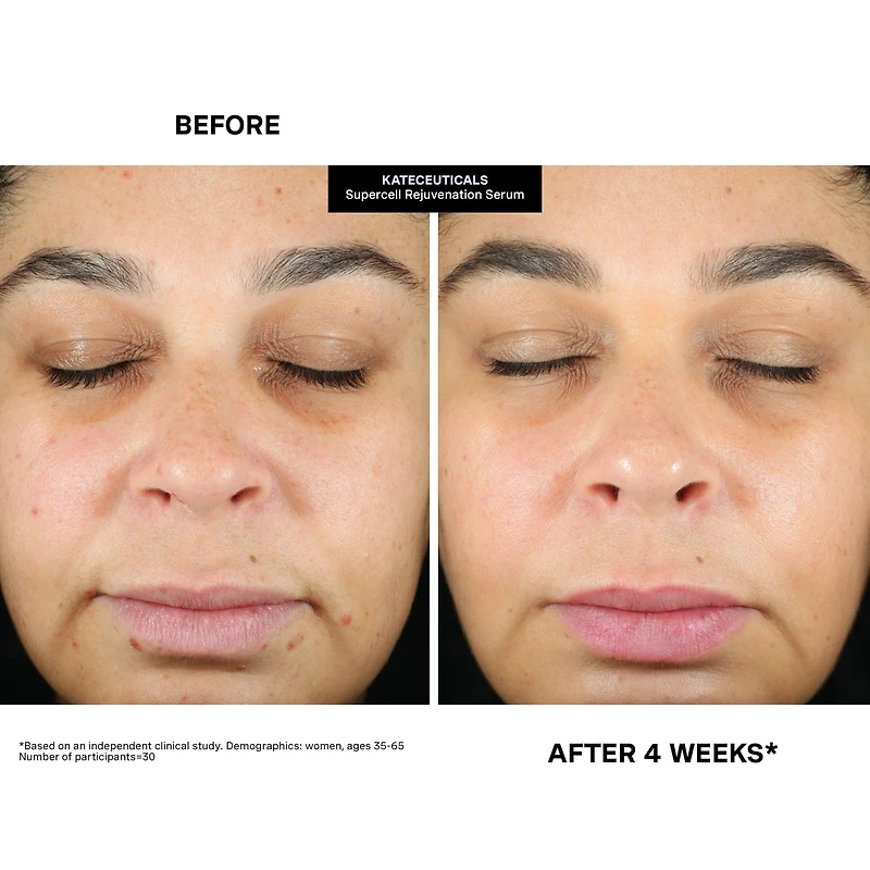 KateCeuticals® SuperCell Rejuvenation Peptide Serum