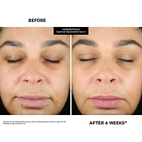 KateCeuticals® SuperCell Rejuvenation Peptide Serum