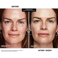 KateCeuticals® SuperCell Rejuvenation Peptide Serum