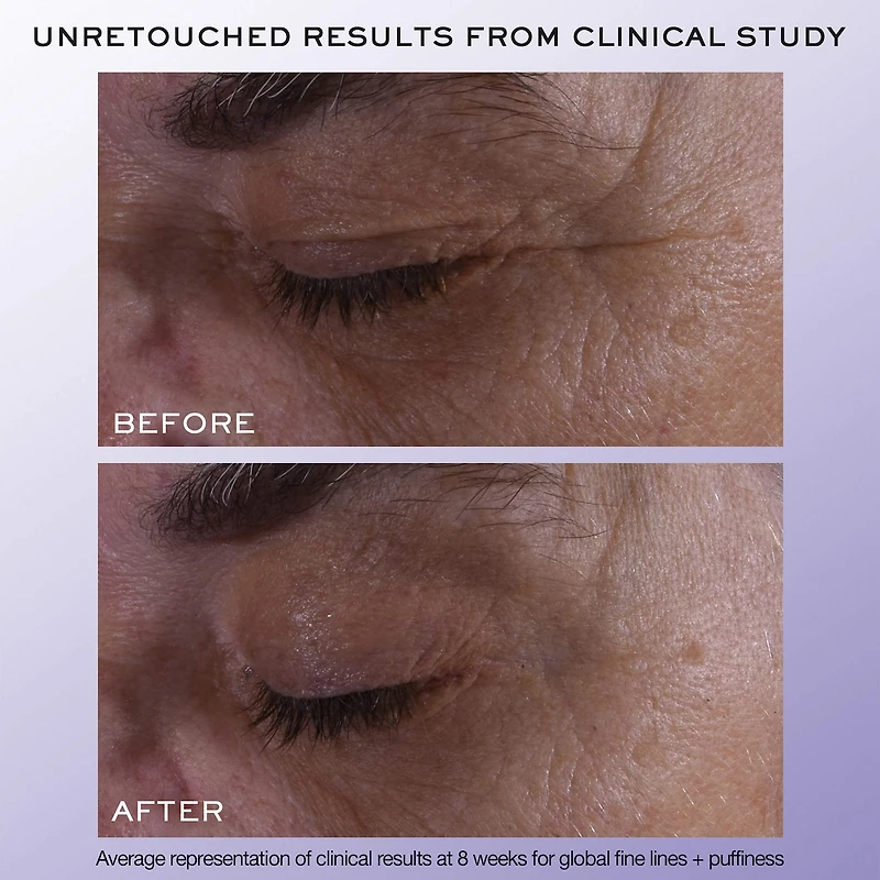 Rénergie H.C.F. Triple Eye Serum