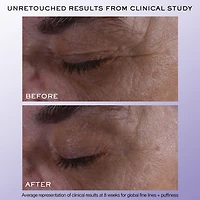 Rénergie H.C.F. Triple Eye Serum