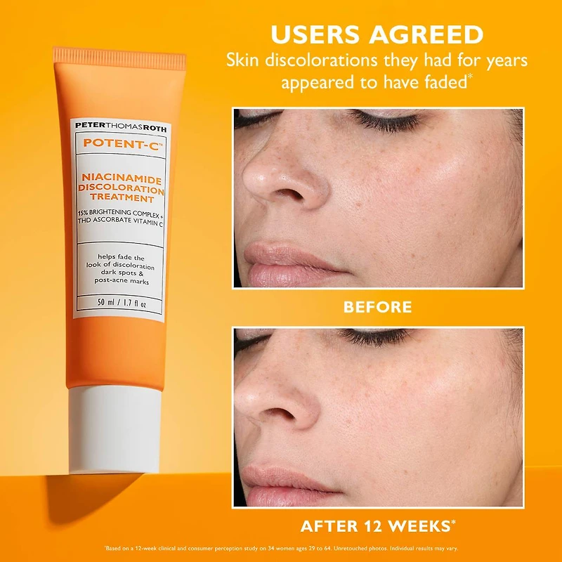 Potent-C™ Niacinamide Discoloration Treatment