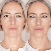 Best Skin Days SPF30 Whipped Tinted Moisturizer with Vitamin C + Hyaluronic Acid