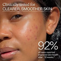 Clear Skin Physician-formulated Supplement for Acne and Breakouts