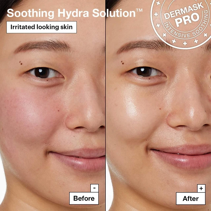Soothing Hydra Solution™ PRO Face Mask for Irritated Skin