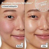 Soothing Hydra Solution™ PRO Face Mask for Irritated Skin
