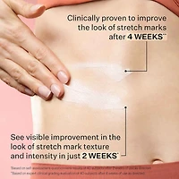 SD Advanced™ PLUS Intensive Moisturizer for Stretchmarks and Wrinkles