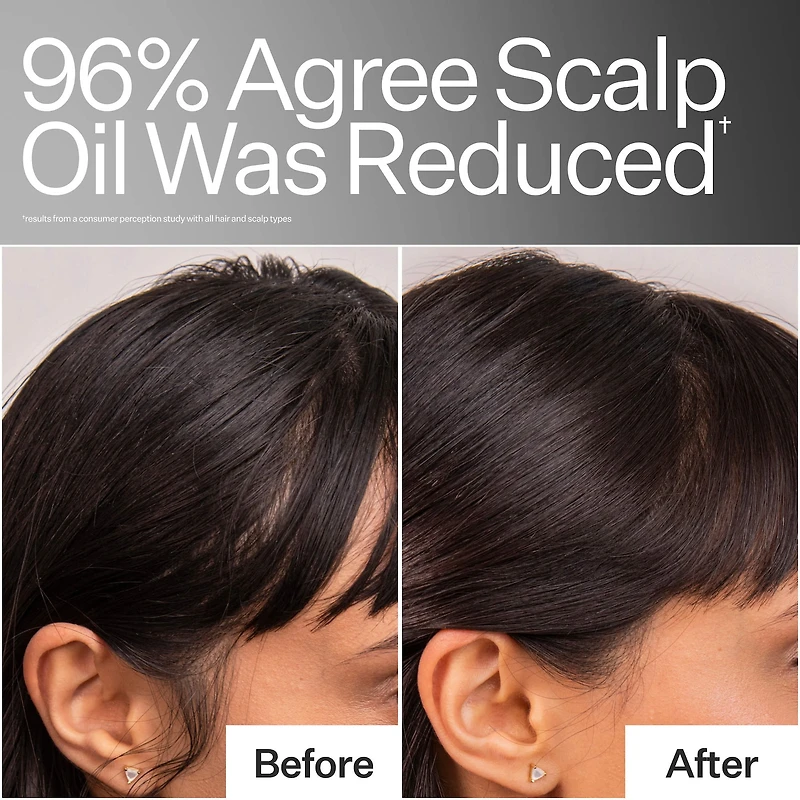 4% Niacinamide Scalp Serum For Oily Scalp + Hair