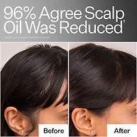 4% Niacinamide Scalp Serum For Oily Scalp + Hair