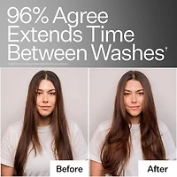 4% Niacinamide Scalp Serum For Oily Scalp + Hair