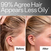 4% Niacinamide Scalp Serum For Oily Scalp + Hair
